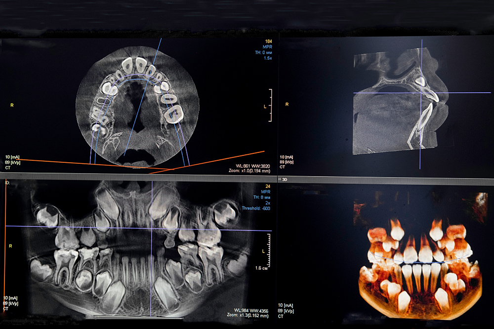CBCT Imaging 