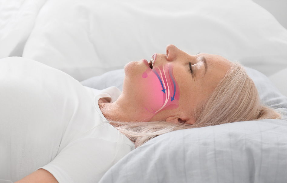 Image of an older woman snoring, showing the need for Sleep Apnea & Snoring Treatment
